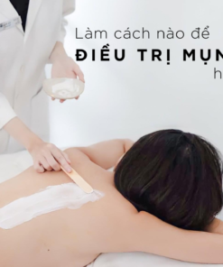Điều trị mụn lưng